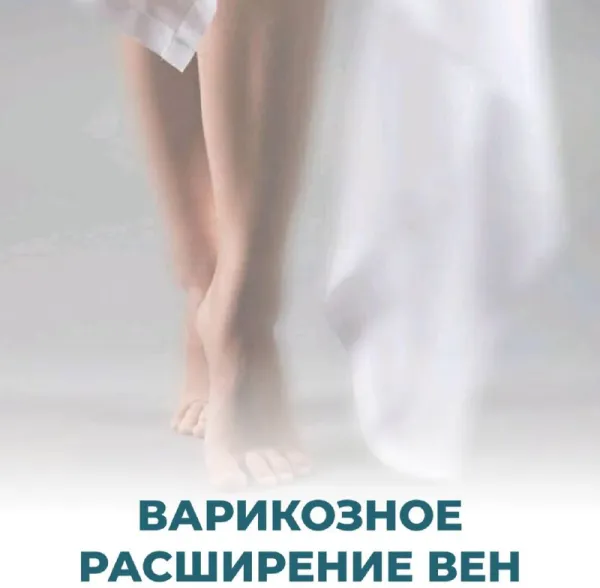 Варикозное расширение вен малого таза при беременности