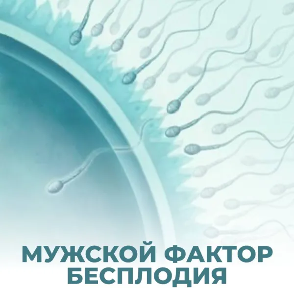 Мужской фактор бесплодия: причины, симптомы, диагностика